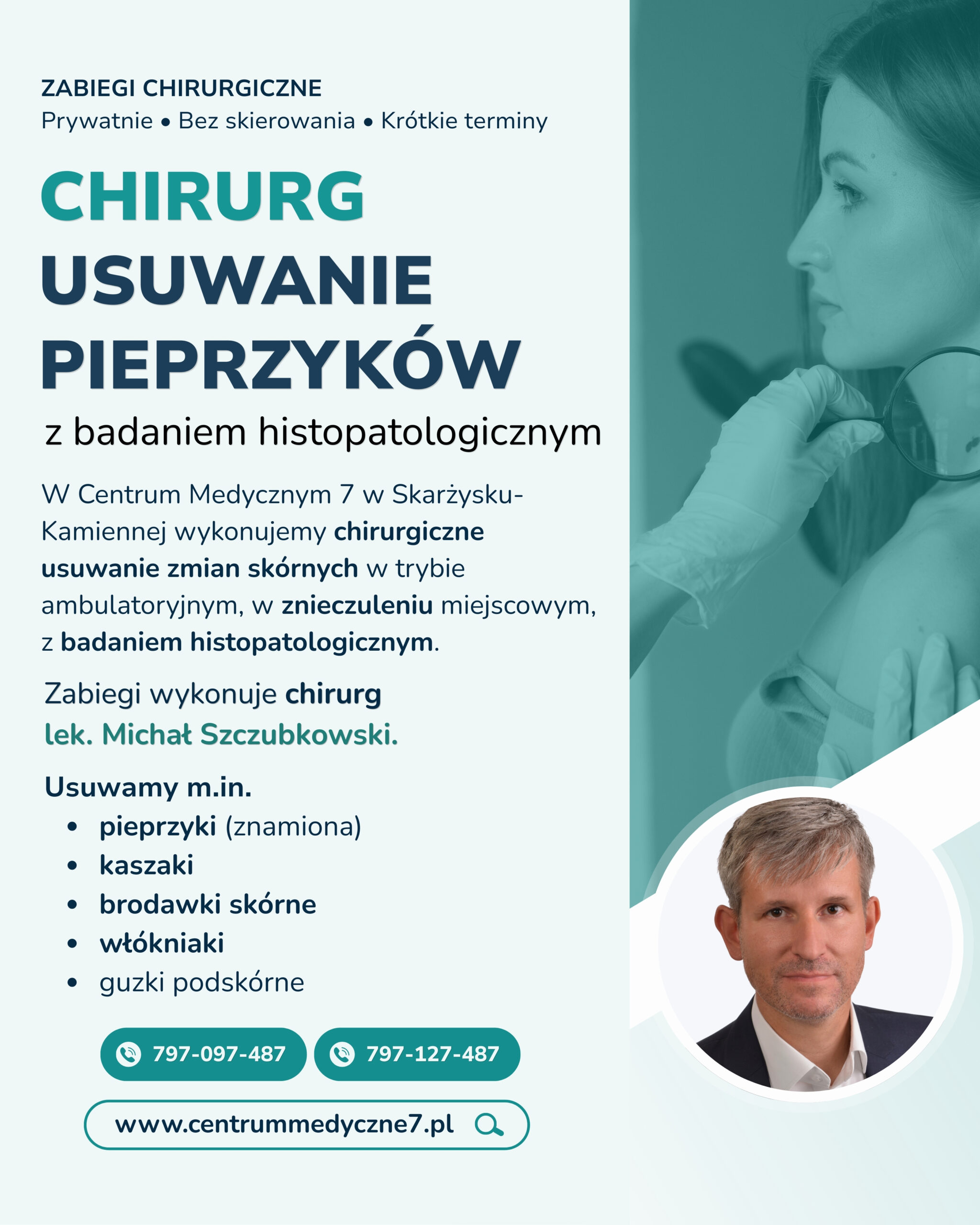 Usuwanie pieprzyków Skarżysko – chirurgiczne usuwanie znamion